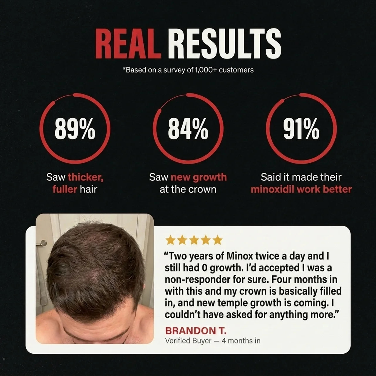 Hair Regrowth Accelerator Kit