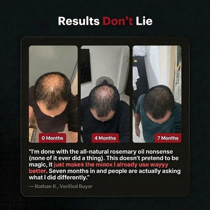 Hair Regrowth Accelerator Kit