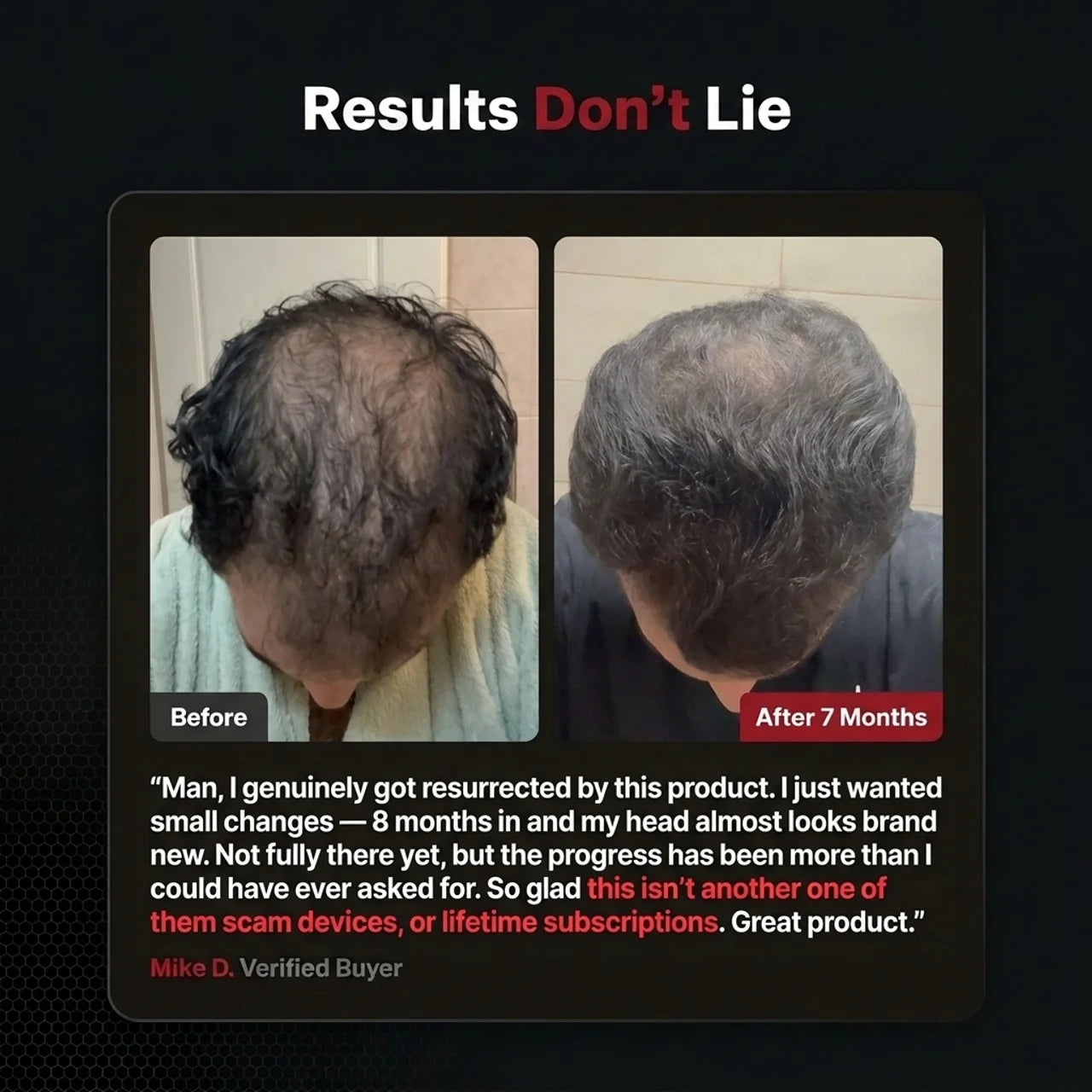 Hair Regrowth Accelerator Kit