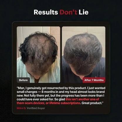 Hair Regrowth Accelerator Kit